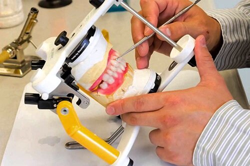 در لابراتوار دندانپزشکی چه کارهایی انجام می شود؟