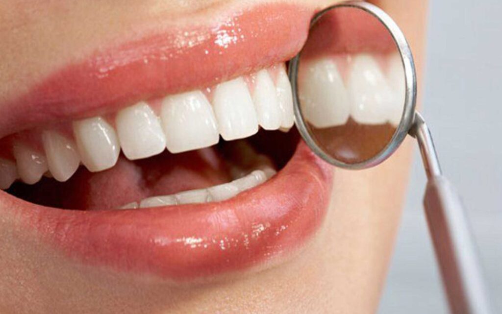 شباهت -  عملکرد مشابه ایمپلنت و دندان طبیعی 