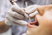 روشهای ترمیم دندان
