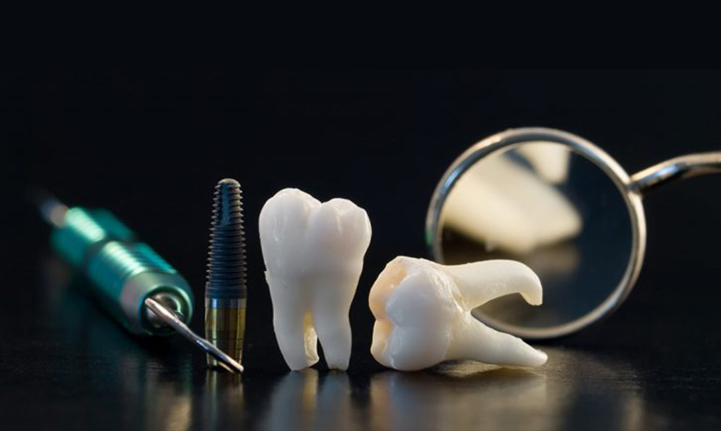 آشنایی اصطلاحات دندانپزشکی و بررسی انواع خدمات و درمان های دندانپزشکی 6 دندانپزشک