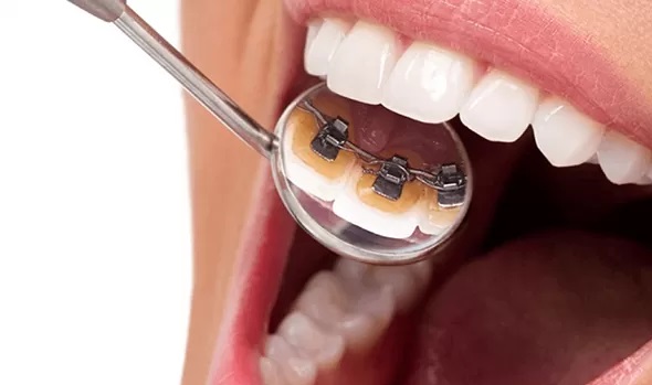 نامرئی بودن