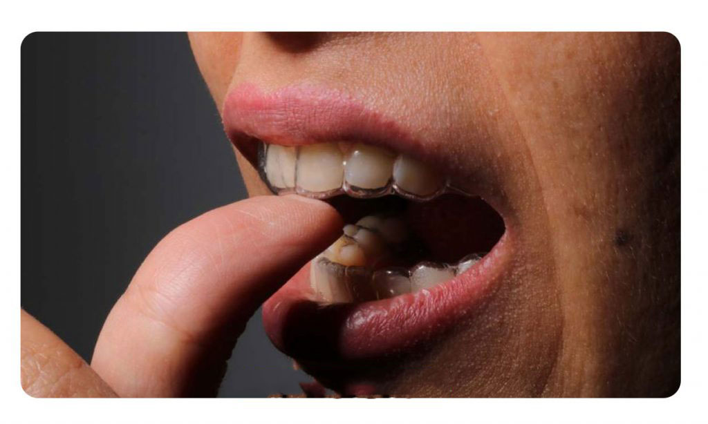 متحرک برای درمان ناهنجاری در حال حاظر