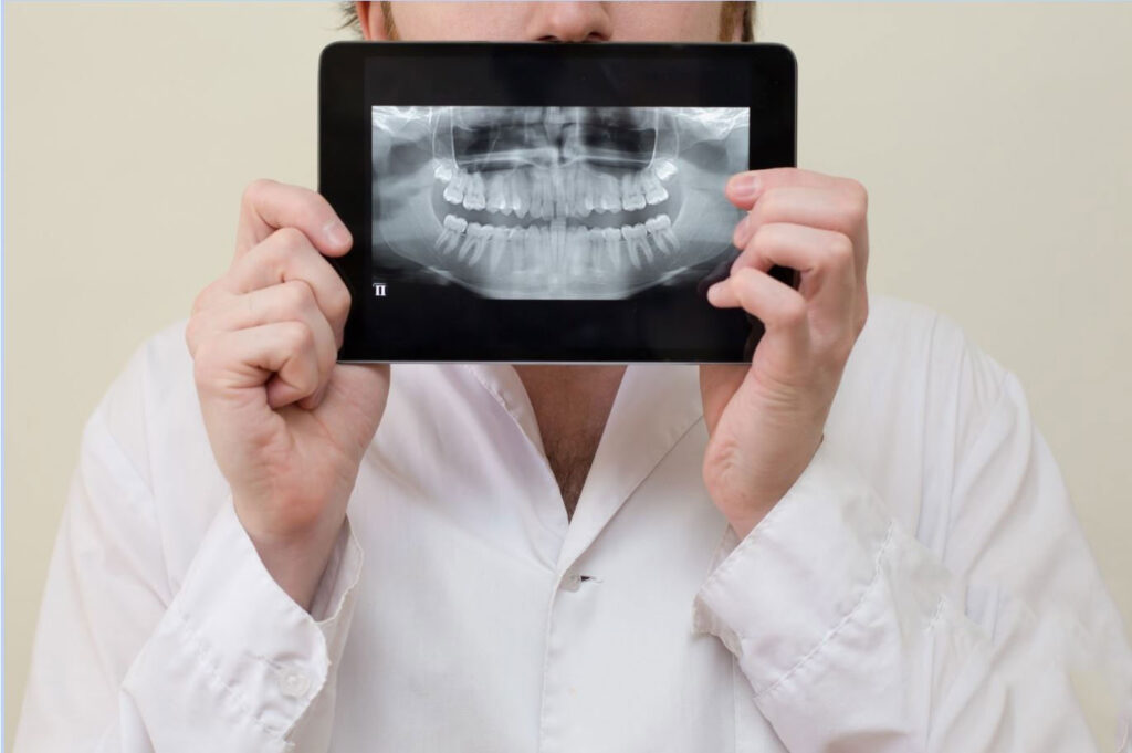 مزایای رادیولوژی دیجیتال