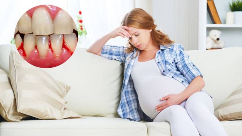 هورومون‌های بارداری و مشکلات دندان