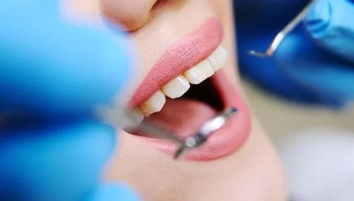 پاک‌سازی بخشی که ایمپلنت در آن انجام شده است.