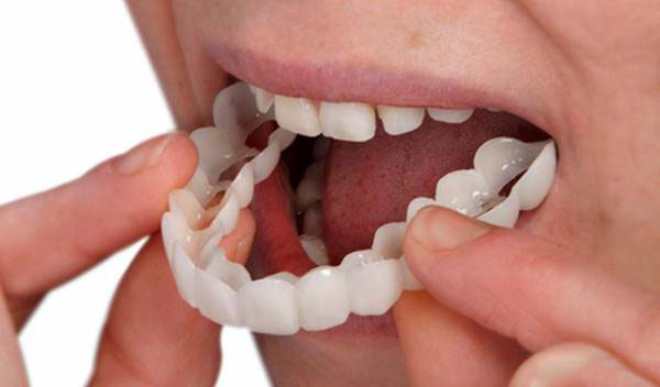 پروتز دندانی متحرک