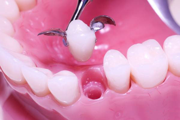 پروتز دندان ثابت