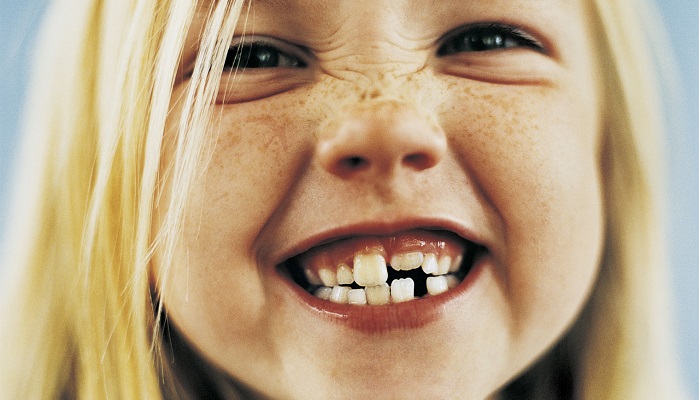 دندان قروچه چه اثراتی دارد؟