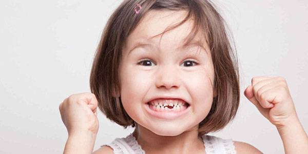 دندان قروچه یا براکسیسم چیست؟