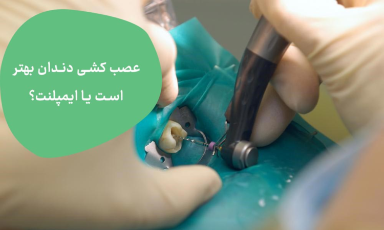درمان ایمپلنت دندان