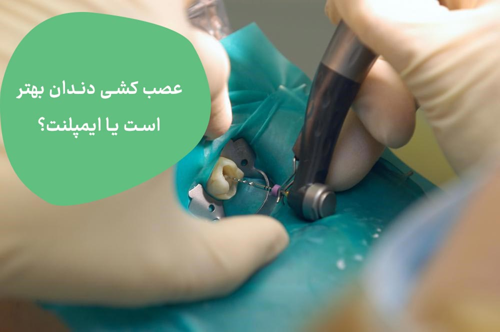 درمان ایمپلنت دندان