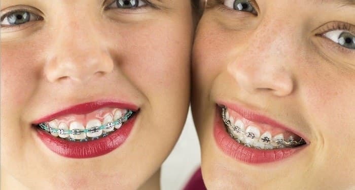  نخ دندان کشیدن