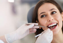 متخصصان لمینت دندان
