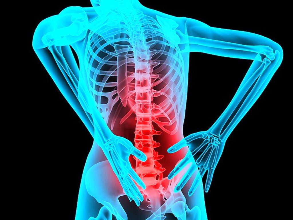 کمردرد غیراختصاصی