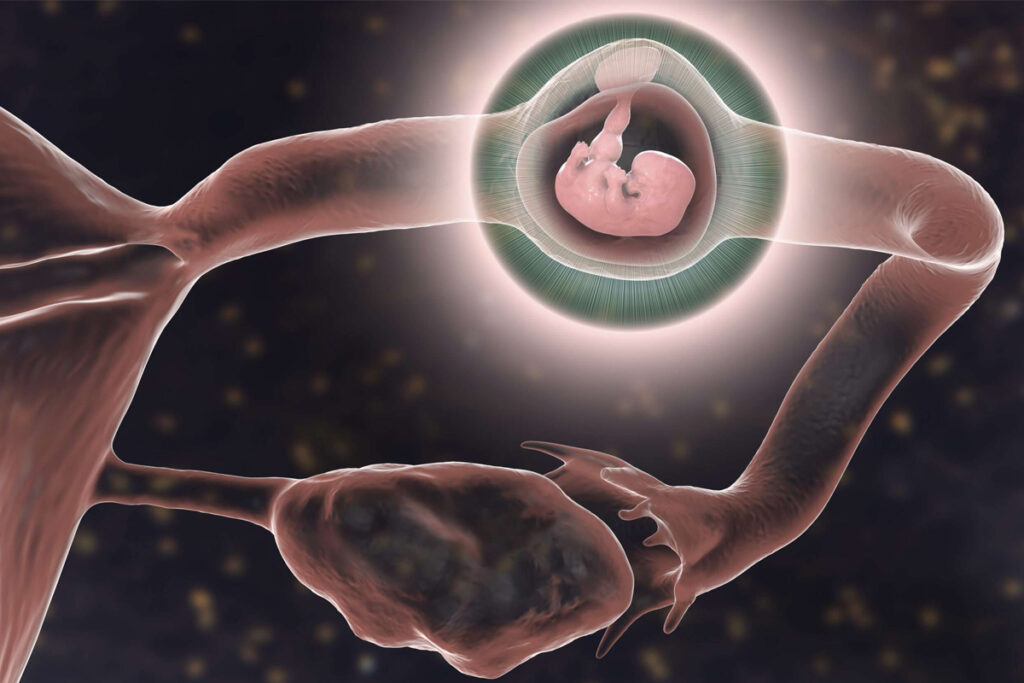 ایا سونوگرافی بارداری خارج از رحم را نشان می دهد؟ 5 سونوگرافی بارداری خارج از رحم