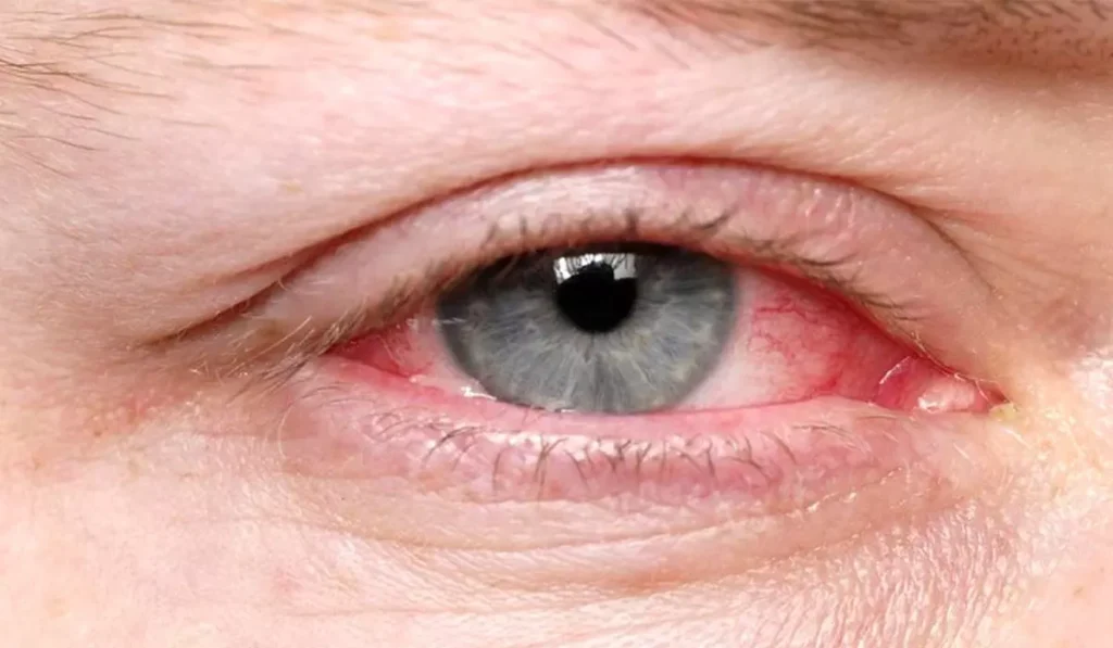 تشخیص لنز چشم چپ و راست