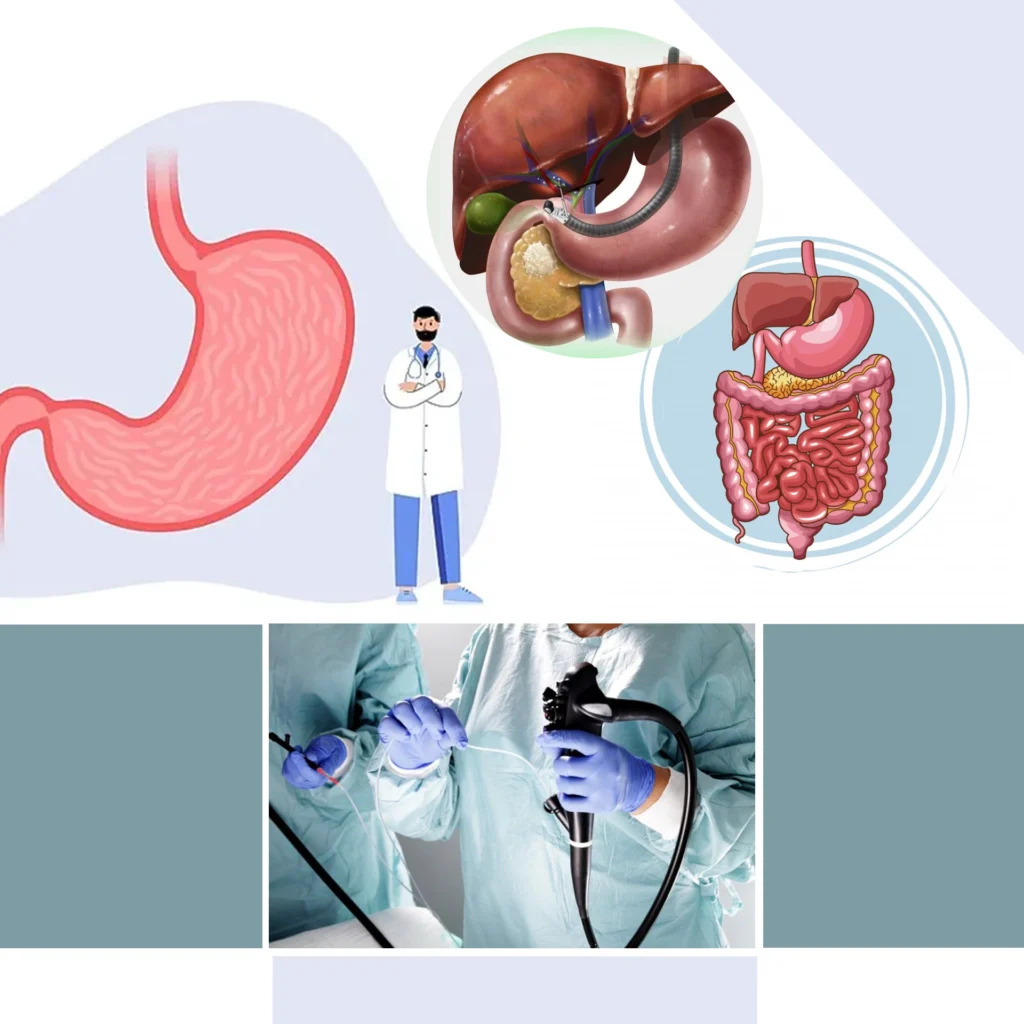 گوارش در معده