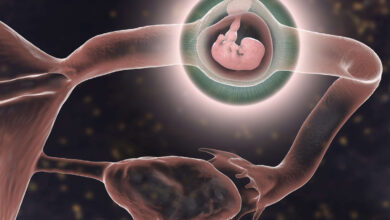 سونوگرافی بارداری خارج از رحم