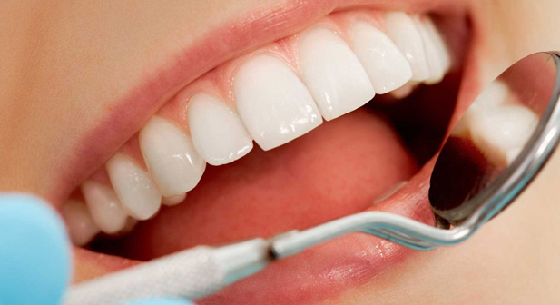 لمینت کریستالی چه کاربردی دارد؟ 5 لمینت کریستالی چه کاربردی دارد؟