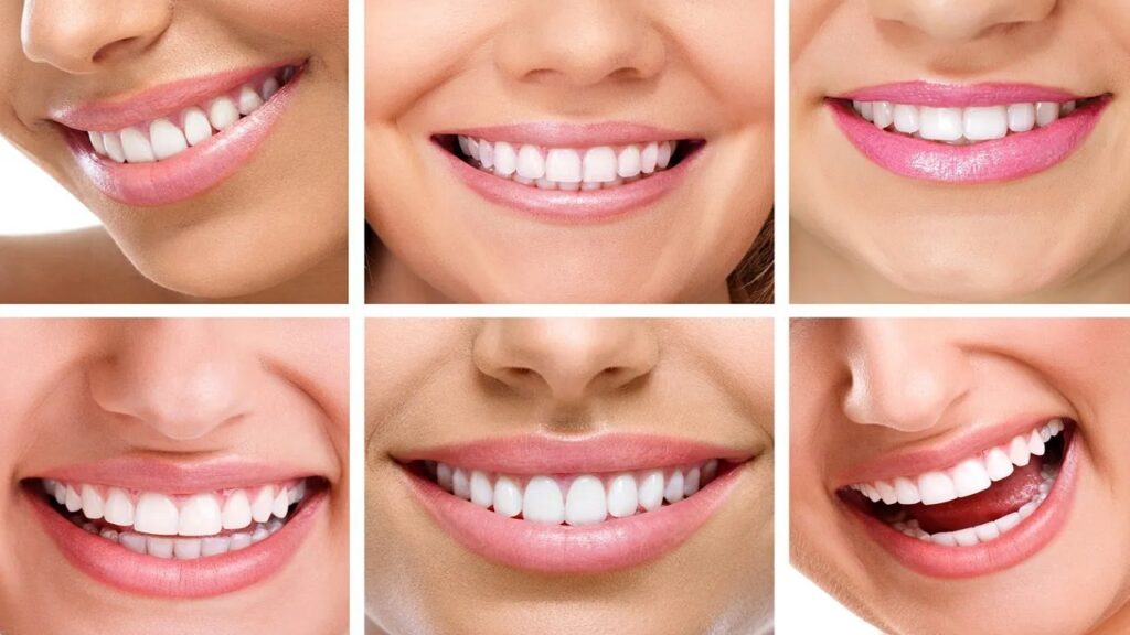 تفاوت لمینت و کامپوزیت چیست؟ 4 تفاوت لمینت و کامپوزیت