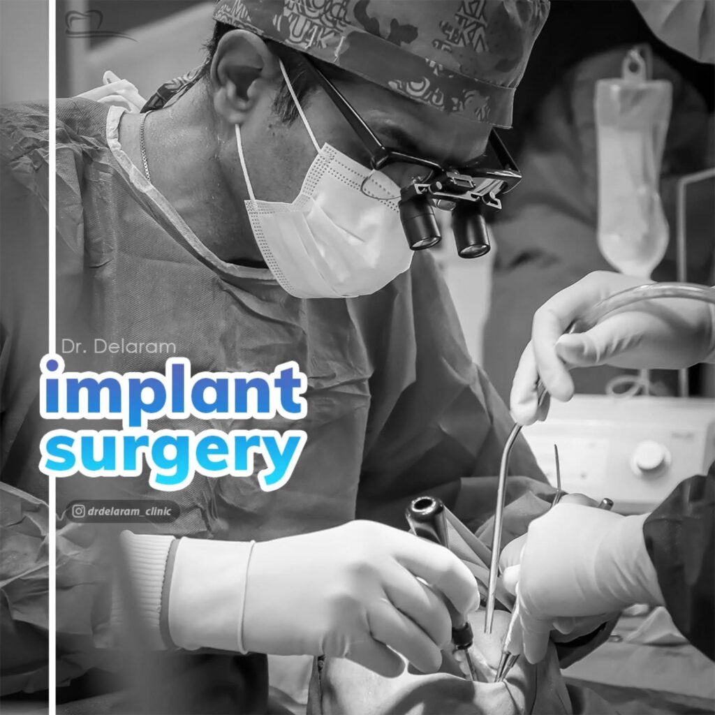 ایمپلنت دیجیتال در کلینیک دکتر دل آرام: آینده کاشت دندان با فناوری پیشرفته 4
