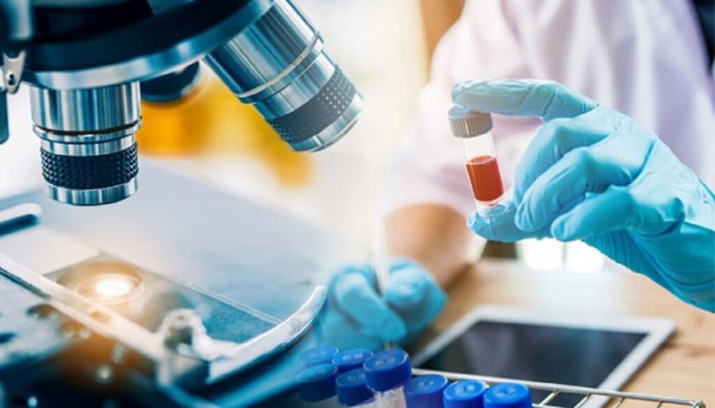 آزمایش در منزل ارومیه