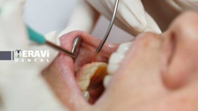 حذف تودهها و کیستهای لثهای: روشهای نوین جراحی و لیزری