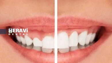 جراحی لثه: از درمان بیماری تا زیبایی لبخند + معرفی روشهای لیزری و سنتی