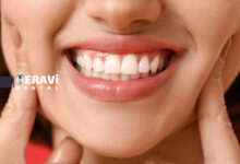 بهترین مکمل ها برای سلامت دهان و دندان راهنماي کامل انتخاب موثرترين تقويت کننده ها