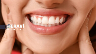 بهترین مکمل ها برای سلامت دهان و دندان راهنماي کامل انتخاب موثرترين تقويت کننده ها