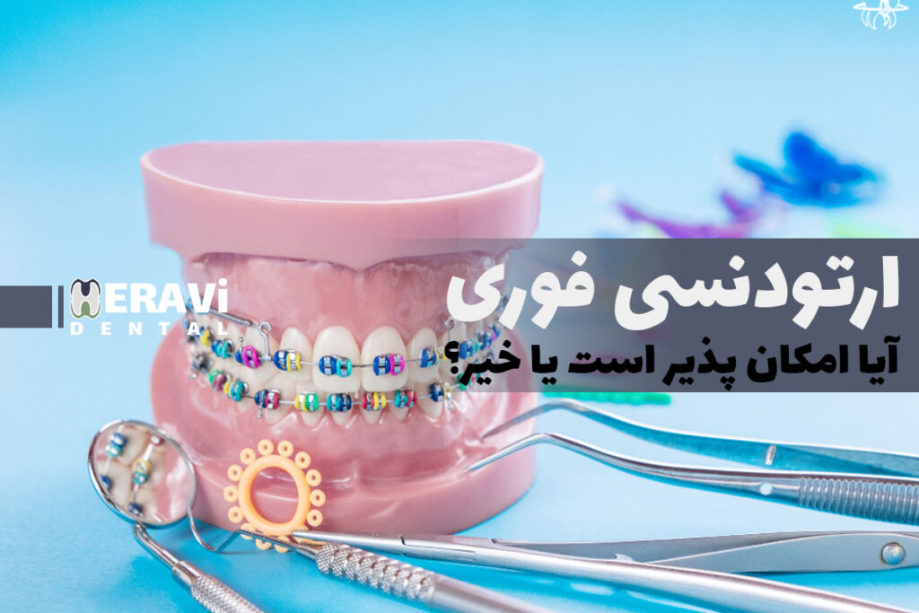 ارتودنسی سریع؛ واقعیت یا تبلیغ اغراق امیز؟ 7 ارتودنسی سریع؛ واقعیت یا تبلیغ اغراق امیز؟