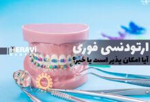 ارتودنسی سریع؛ واقعیت یا تبلیغ اغراق امیز؟
