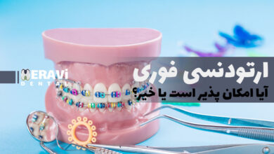 ارتودنسی سریع؛ واقعیت یا تبلیغ اغراق امیز؟