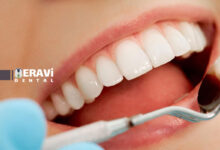 تاثیر ویتامین D بر استحکام مینای دندان و راهکارهای جلوگیری از پوسیدگی دندان