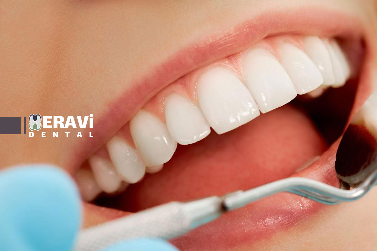 تاثیر ویتامین D بر استحکام مینای دندان و راهکارهای جلوگیری از پوسیدگی دندان