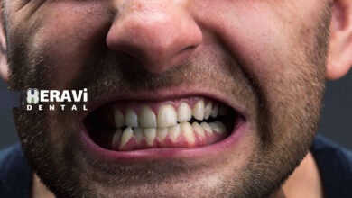 خواب منظم چگونه از دندان قروچه جلوگیری می کند؟ راهکارهای علمی برای کاهش استرس شبانه