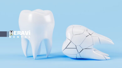 دندان شکسته و خطر عفونت: چرا اقدام فوری حیاتی است؟